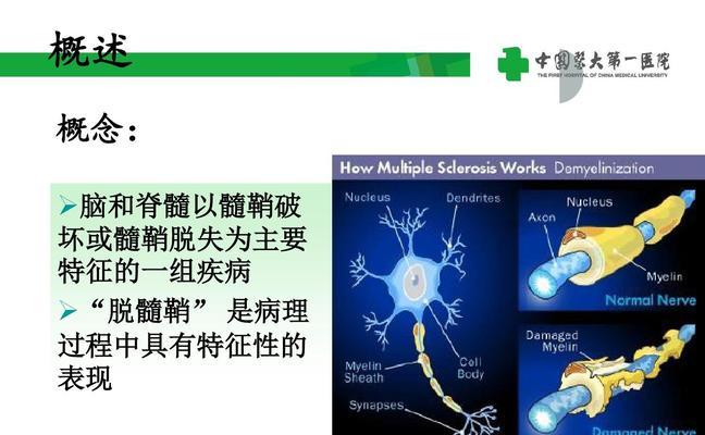 探秘人体工厂-通关中枢神经的游戏技巧（如何在游戏中突破人体神经中枢）