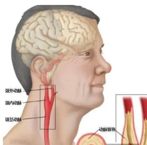 《机动战队饕餮改机体配装指南》（掌握关键）